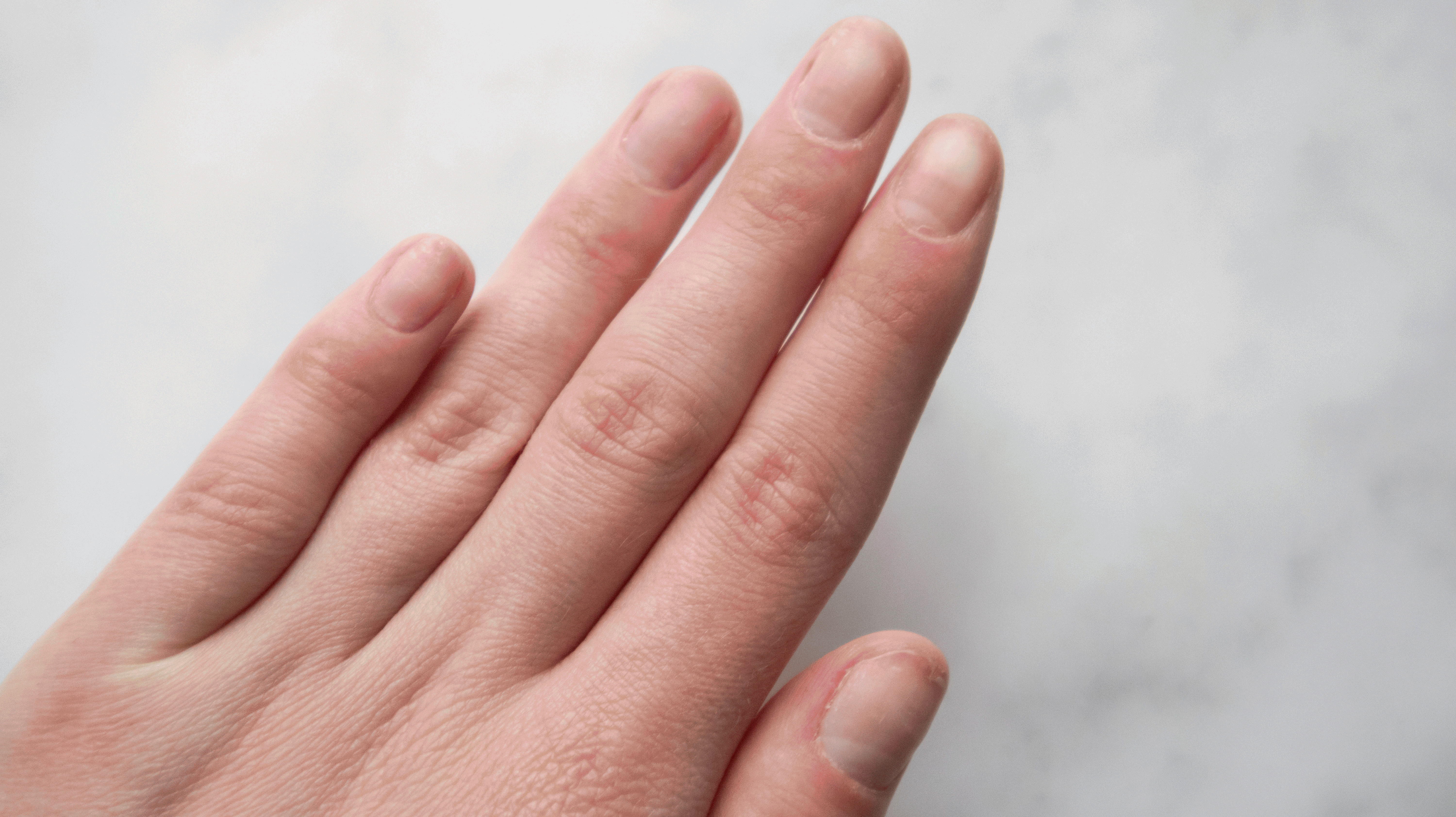 Nails, struggles, nagels lakken